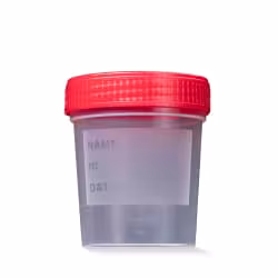 Urinsammelbehälter mit rotem Schnappdeckel